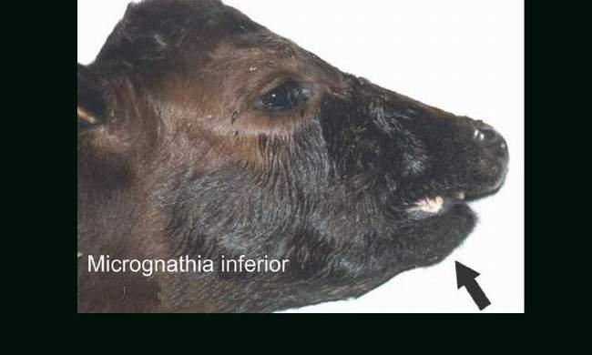 micrognathia inferior